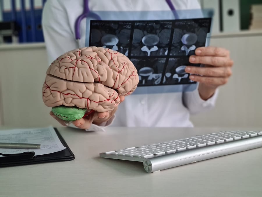 Best Neurosurgeon in Mysore
